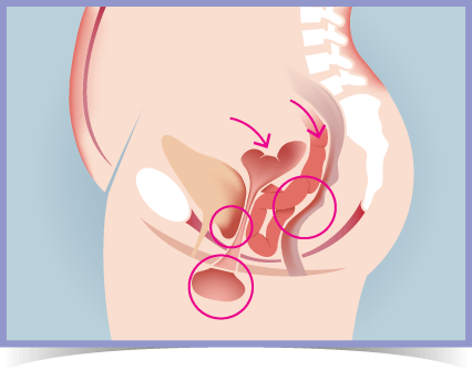 Pelvic Pro Therapy, Greater Orlando Area