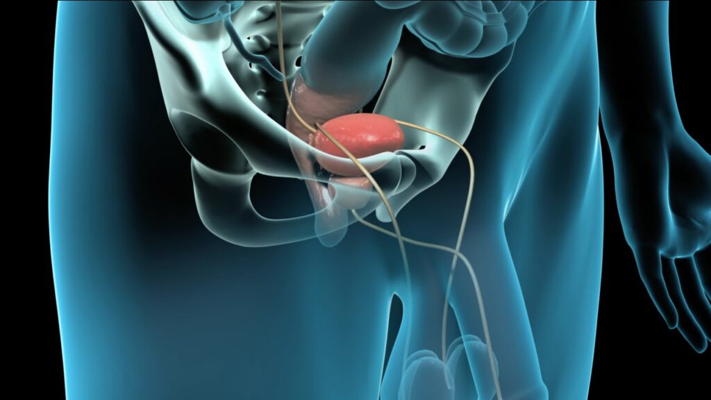Pelvic Pro Therapy, Greater Orlando Area