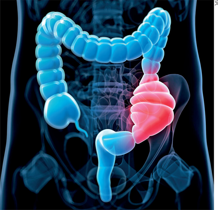 Pelvic Pro Therapy, Greater Orlando Area
